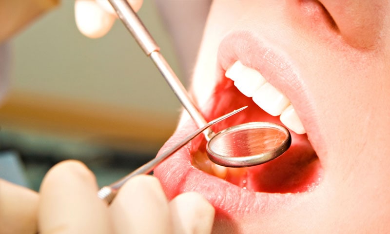 Профилактика заболеваний слизистой оболочки полости рта