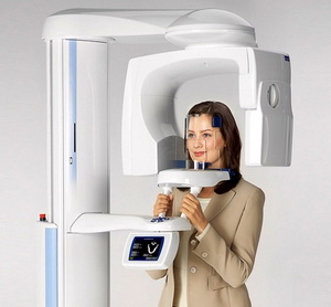 Цифровая телерентгенограмма (ТРГ)