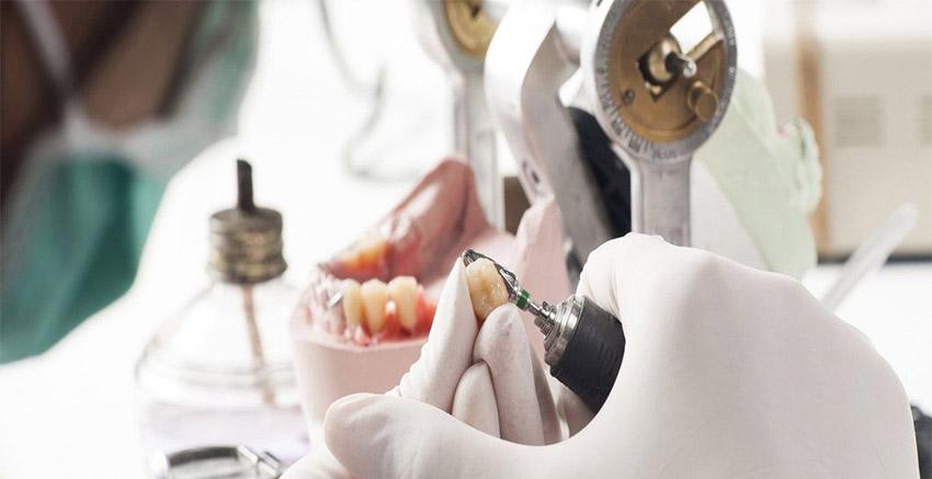 Преимущества собственной зуботехнической лаборатории в клинике