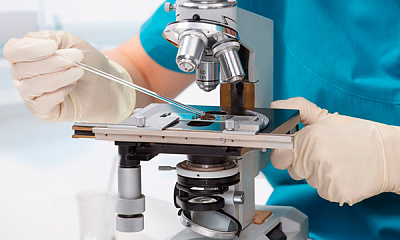 Риноцитограмма (исследование клеточного состава назального секрета)